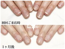 オジー 下北沢(OZZY)の雰囲気（噛む癖、むしる癖、人前で指先を出すのが気になる方へ深爪育成☆）