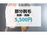 【メンズ脱毛】【両腕・両脚】ジェルなし部分脱毛♪¥5,500
