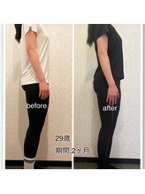 24ダイヤモンドジム 西宮店(24 DIAMOND GYM)/before/after