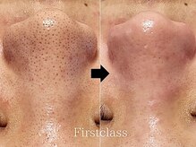 ファーストクラス(First Class)の雰囲気（韓国肌管理★毛穴洗浄・導入系や小顔フェイシャルまでお悩み対応）