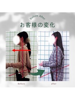 わく整体院/猫背・姿勢改善