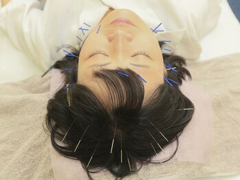 寝屋川かわい鍼灸整骨院の写真/美肌やお肌の潤いをアップしてカラダの内側から綺麗に整えるケアを体験◎東洋医学ならではの優しい施術