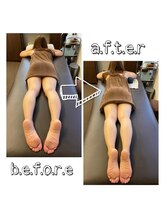 アンドユー カゴシマ(&you kagoshima)/美容整体