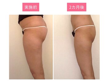 プレミアムマッサージサロン 自由が丘店(premium massage salon)/ビジリス・美尻イス