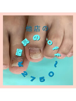 巻き爪補正店 大阪なんば店/器具除去