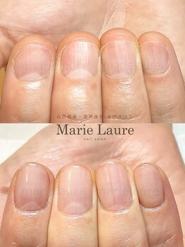 マリーロール 天王寺店(Marie Laure)/深爪改善/自爪育成/ネイルケア