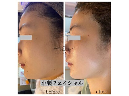 アンド リー(and lee)の写真