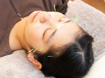 むろたはり きゅう院/【施術風景】美容鍼