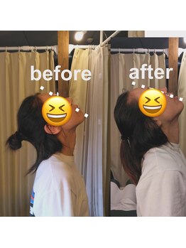 カイロプラクティック 整体 三日月/可動域の変化