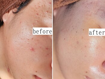 ユウビジン(YOU美人)/