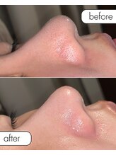 サロン ド カスケード(Salon de Cascade)/10代女性