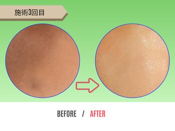 癒し工房ゆらぎ(YURAGI)/BEFORE/AFTER