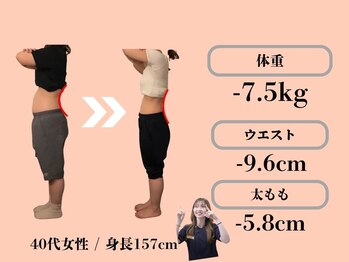 エステティックトレーニングサロン ボディネイト(Body Nate)/Before/After