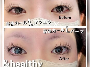 イーストアッカ アイラッシュ(East AkkA eyelash)/Lカール×アンドヘルシー