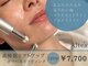 アルテア(Altea)の写真