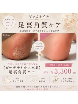 ピッカネイルの写真/《ハンド☆大流行!マグネットワンカラー》超実力派サロンによる高コスパサロン◎