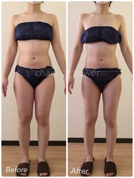 チェイン オブ フラワー(Chain Of Flower)/脂肪分解menu/キレイ痩せ大成功