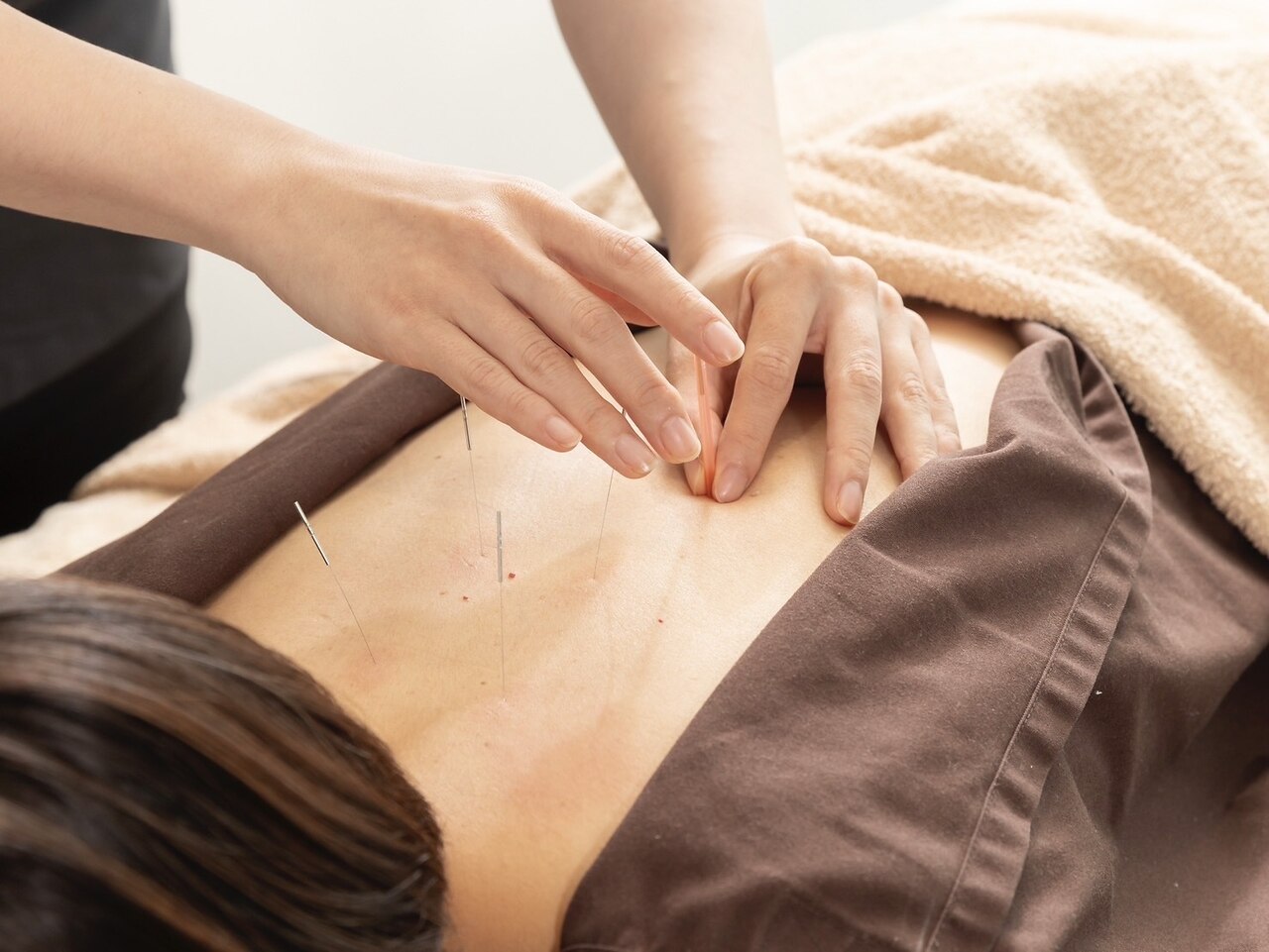 【鍼灸贅沢コース♪】鍼（Anatomic）+整体 75分 ￥9500→￥8200