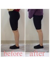 スタイルラボ高松/産後骨盤矯正の効果