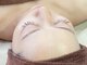 スマイルビューティラボ(Smile Beauty lab.)の写真/【本格派！結果にこだわる大人女性に】韓国肌管理★水光肌LHAララピール×LDM