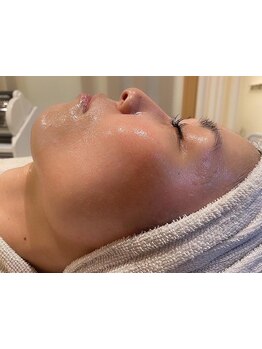 ハリツヤをUPしたい