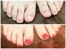 グレースレディ 神戸北店/