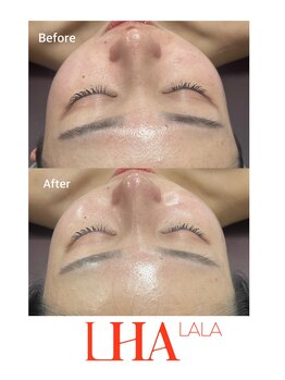 トゥインクル(Twinkle)/ツヤツヤ美肌になれる!