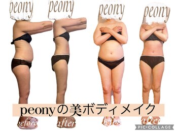 ピオニー(PEONY)/痩身 サイズダウン 短期集中