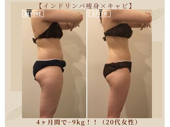 オキシー グレイス 黒崎店(OXY Grace)/インドリンパ痩身×キャビ