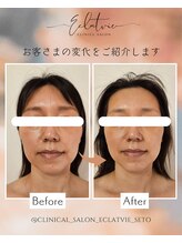 エクラヴィ(Eclatvie)/５０代★女性