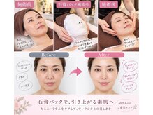 クィーンズビューティー(Queen's Beauty)の雰囲気（たるみ、毛穴、乾燥、くすみ、たるみ毛穴までケア。小顔効果も！）