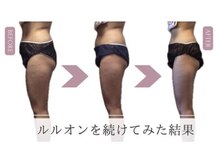 ヨサパーク ルーツ 高幡不動店(YOSAPARK Roots)の雰囲気（ぽっこりお腹/二の腕/太もも/ハミ肉/下半身お任せ下さい！）
