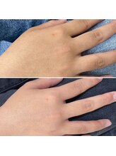 ムーウ(MuuU)/Before→After