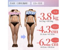 アフリオーラ はなみずき店(affriolant)/ビフォーアフター