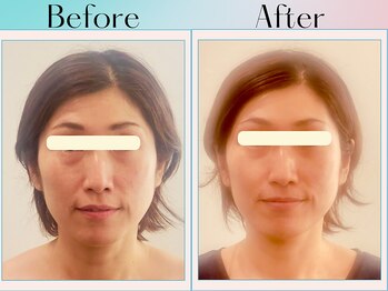 天空の手もみ/小顔矯正/吉祥寺/荻窪/西荻窪