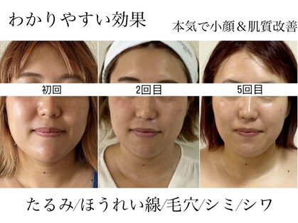 お顔の印象の写真