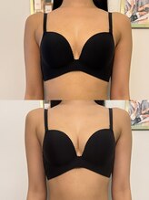 ドリームバスト 日本橋(Dream Bust)/姿勢まで改善