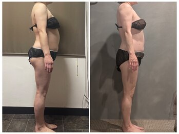 ツーアップ(2up)/反り腰