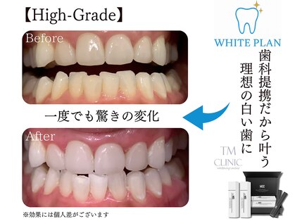 ホワイトプランの写真