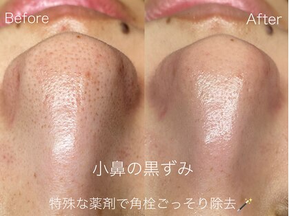 ラティーナ(Lattina)の写真