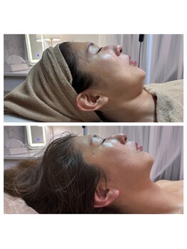 クリア 栄生(CLEAR)/クリスティーナ|Forever Young