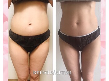 ヨサパーク ホロムア(YOSA PARK*Holomua)/痩身サロン