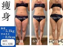 アナパ・オラ/マグニート×6種痩身マシン