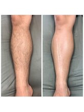 ファースト(1st)/