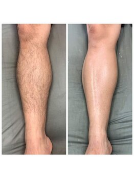 ファースト(1st)/