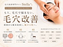 ステラ(Stella)