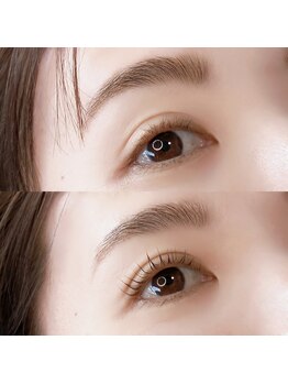 バトン(BATON.)/eyeparm before..after