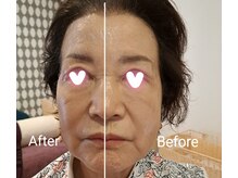 韓国エステサロン 憩の雰囲気(AIマシンコルギ 1回の効果)