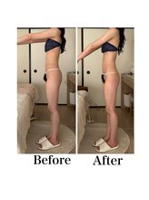 ハリムーン 仙台(harimoon)/ブライダル