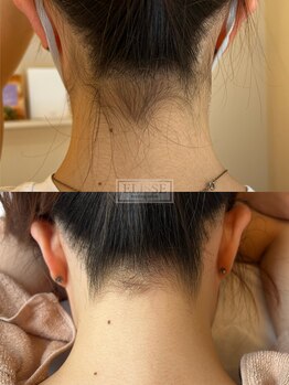 エリス(ELISSE)/成人式前からうなじ脱毛しよう